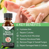 Nail Fungus
