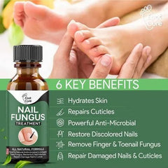 Nail Fungus