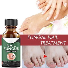 Nail Fungus